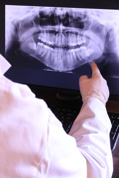 Best Dental Abscess Treatment in Bernie, MO
